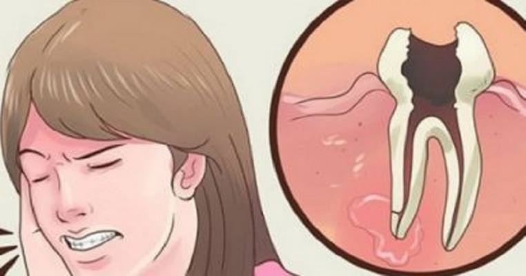 12 All Natural Toothache Remedies your Dentist doesn’t want You to Know About