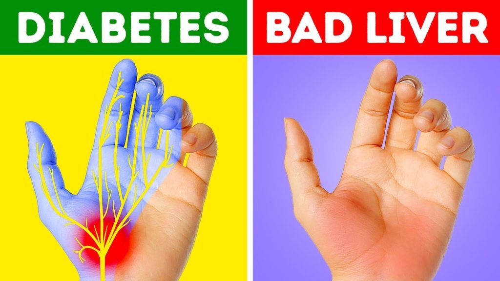 12 Health Problems your hands are warning you about