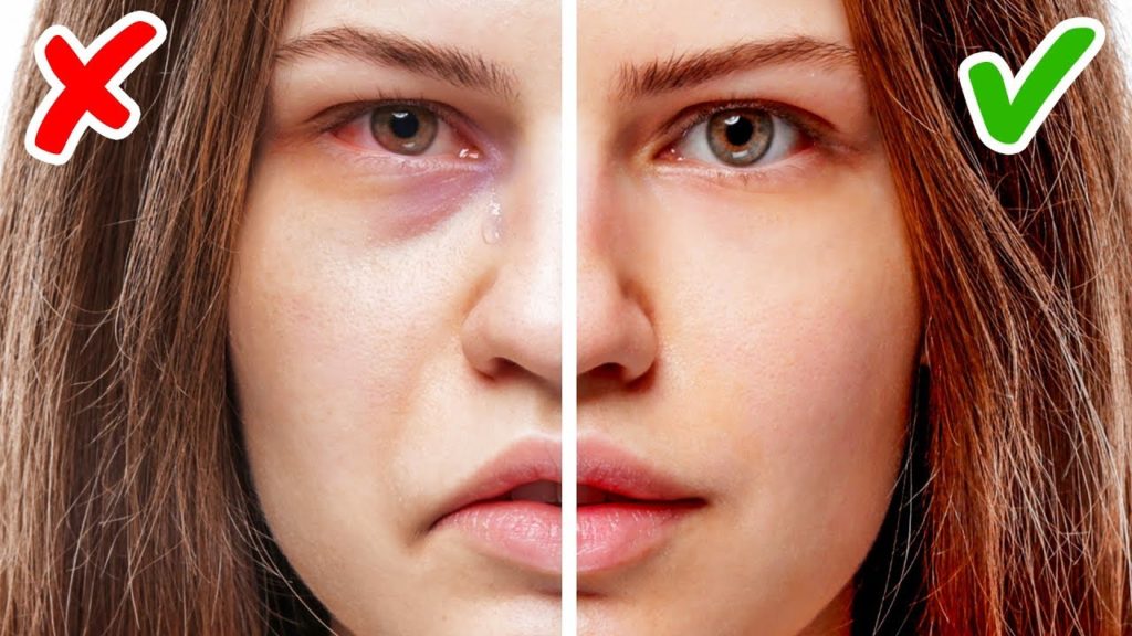 11 Signs of Health Problems hidden on your Face