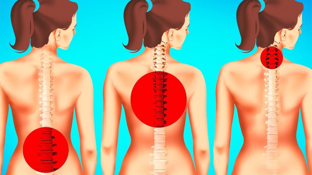 1-Minute Exercises to Improve Posture