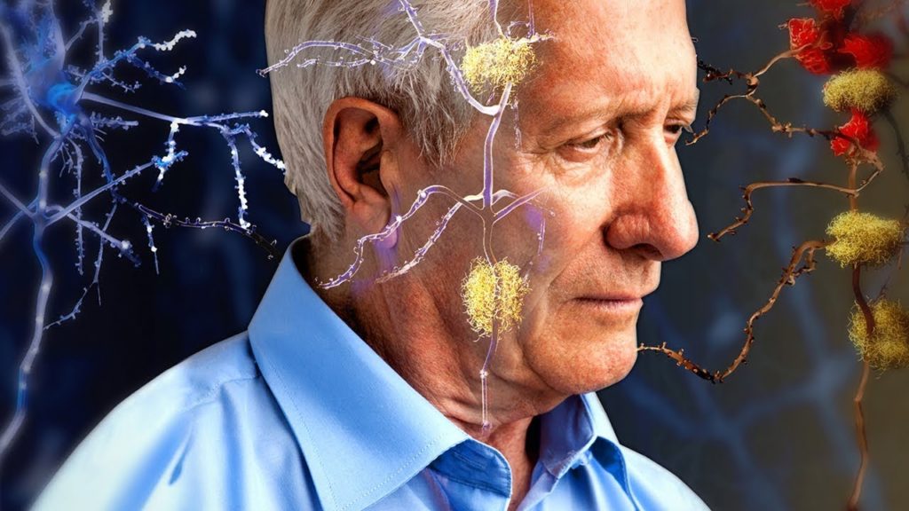 Alzheimer’s or Forgetfulness? How to tell the Difference