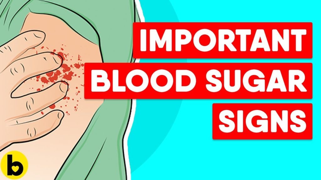 16 Signs Your Blood Sugar is High &  8 Diabetes Symptoms