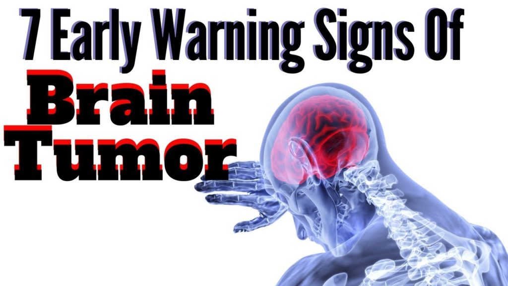 7 Early Warnings of A Brain Tumor to Never Ignore