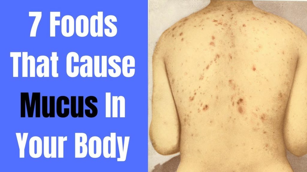 7 Foods that cause Mucus in Your Body