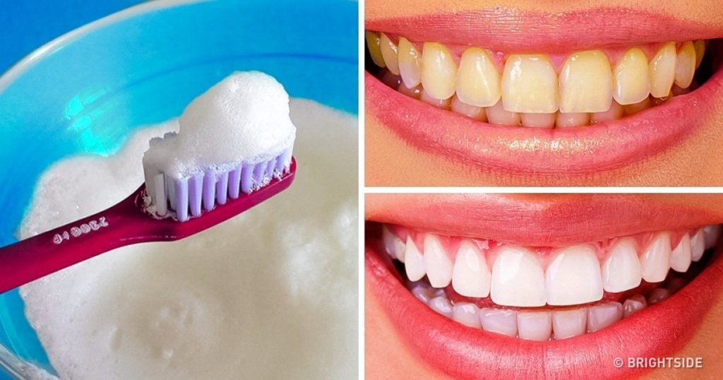 5 ways to Whiten your Teeth naturally