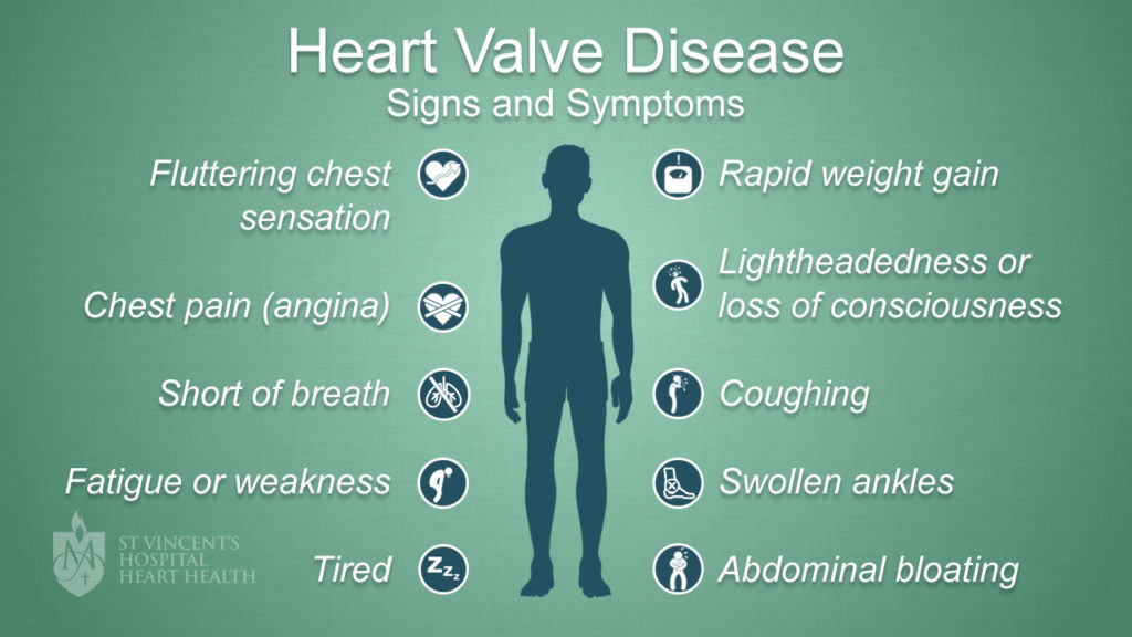 6 Signs during a Workout that reveal possible Heart Problems