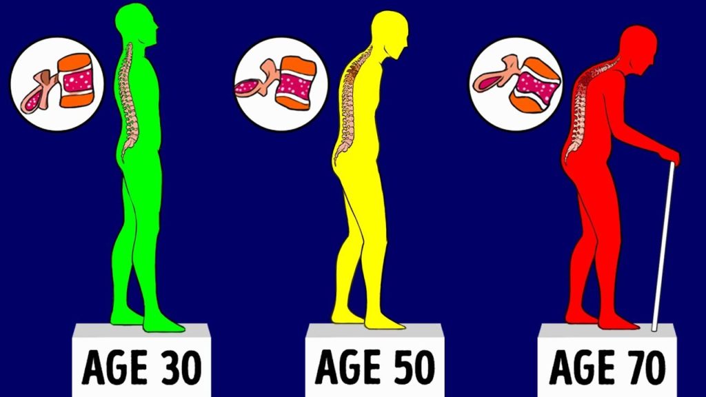 Your Bones are getting weaker, Here’s how to keep them Healthy