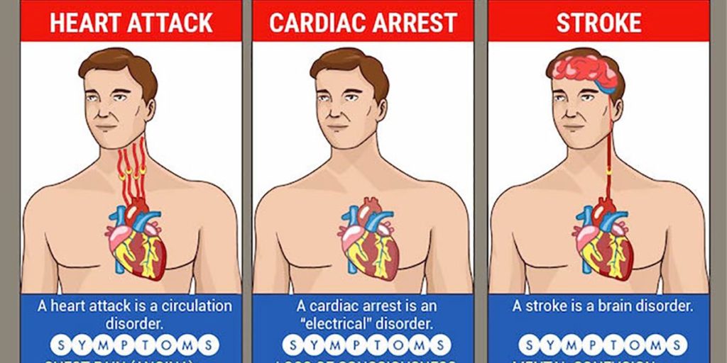 Stroke vs Heart Attack: What’s the Difference & What is Worse?