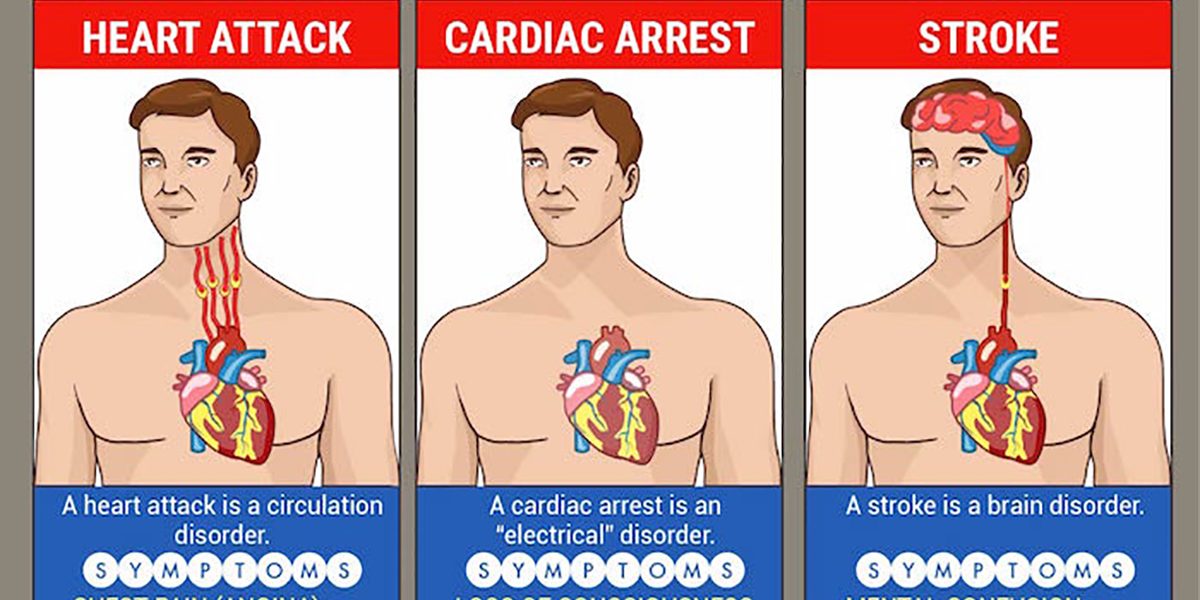 Does Heart Attack Lead To Stroke