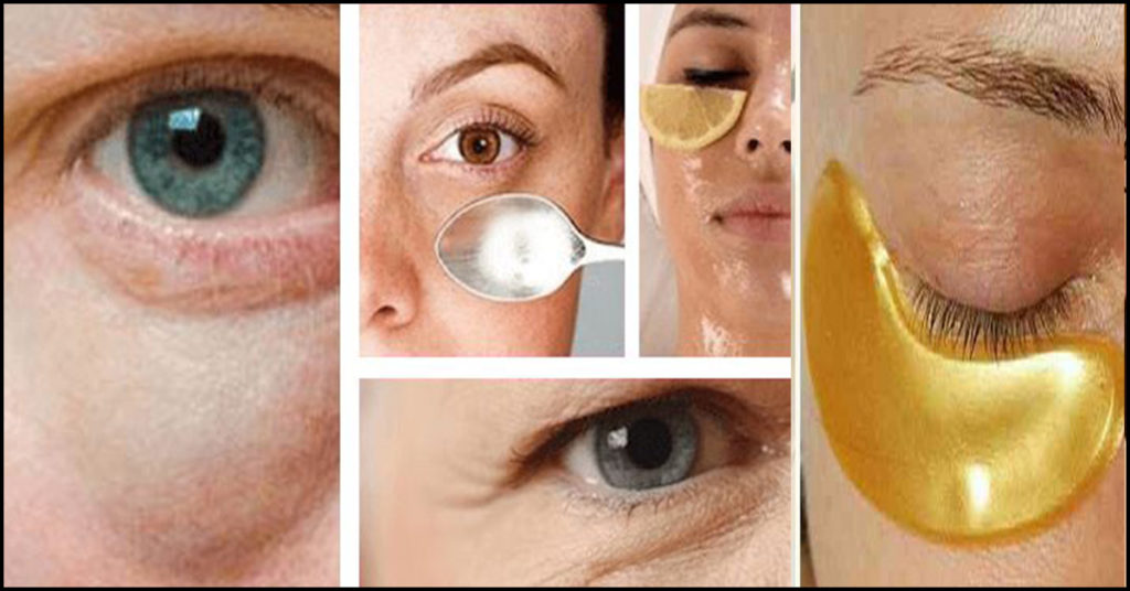 17 Easy Home Remedies to get rid of under Eye Bags