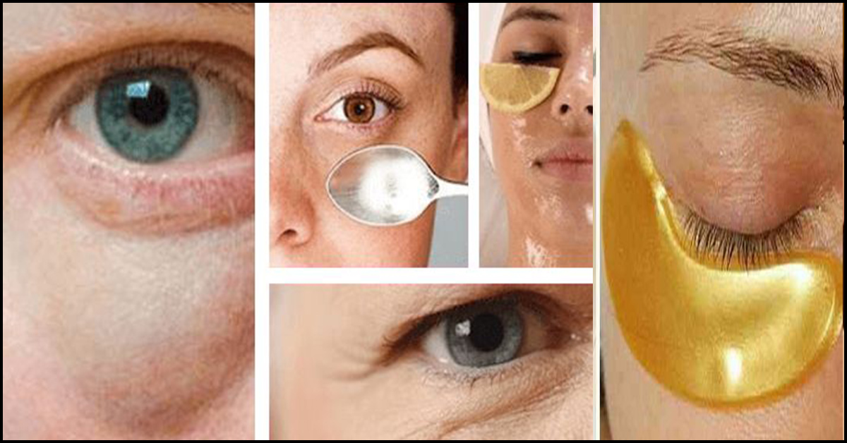 17-easy-home-remedies-to-get-rid-of-under-eye-bags-sports-health