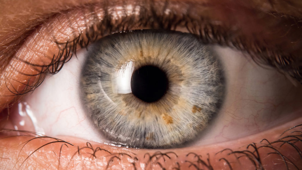 If you’re seeing Eye Floaters, Here’s what to do about them