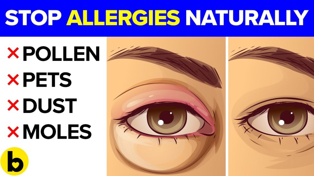 14 Natural ways to Defeat your Allergies